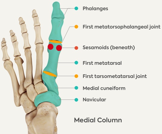 Comprehension Bunions Factors, Indications